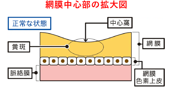 網膜中心部の拡大図